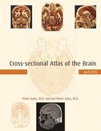 Cross-Sectional Atlas of the Brain and DVD