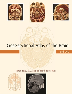 Cross-Sectional Atlas of the Brain and DVD - Ratiu, Peter, and Talos, Ion-Florin