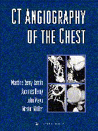 CT Angiography of the Chest - Remy-Jardin, Martine, MD, PhD, and Remy, Jacques, MD, and Mayo, John R, MD