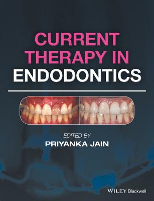 Current Therapy in Endodontics - Jain, Priyanka (Editor)