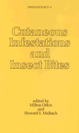 Cutaneous infestations and insect bites