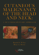 Cutaneous Malignancy of the Head and Neck: A Multidisciplinary Approach