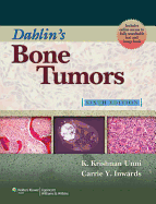 Dahlin's Bone Tumors: General Aspects and Data on 10,165 Cases