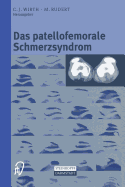 Das Patellofemorale Schmerzsyndrom