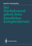 Das Patellofemoralgelenk Beim Knstlichen Kniegelenkersatz