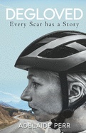 DEGLOVED: Every Scar has a Story