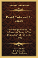 Dental Caries And Its Causes: An Investigation Into The Influence Of Fungi In The Destruction Of The Teeth (1878)