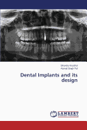 Dental Implants and Its Design - Kaushal Shaveta, and Pal Atamjit Singh