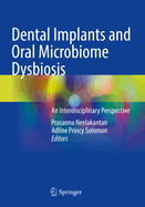 Dental Implants and Oral Microbiome Dysbiosis: An Interdisciplinary Perspective