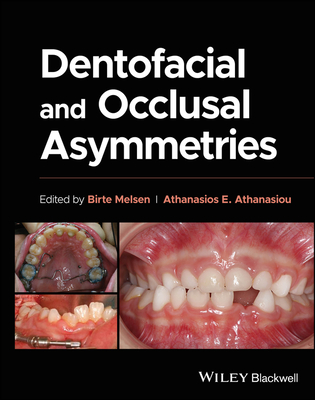 Dentofacial and Occlusal Asymmetries - Melsen, Birte (Editor), and Athanasiou, Athanasios E. (Editor)