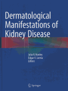 Dermatological Manifestations of Kidney Disease