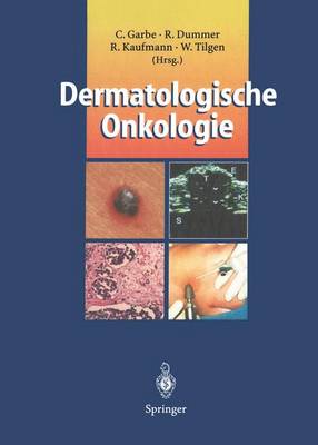 Dermatologische Onkologie - Garbe, Claus (Editor), and Dummer, Reinhard (Editor), and Kaufmann, Roland (Editor)