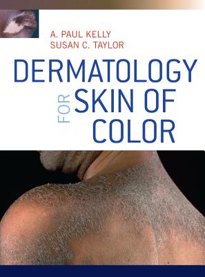 Dermatology for Skin of Color - Kelly, A Paul, and Taylor, Susan