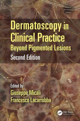 Dermatoscopy in Clinical Practice: Beyond Pigmented Lesions - Micali, Giuseppe (Editor), and Lacarrubba, Francesco (Editor)
