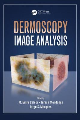 Dermoscopy Image Analysis - Celebi, M. Emre (Editor), and Mendonca, Teresa (Editor), and Marques, Jorge S. (Editor)