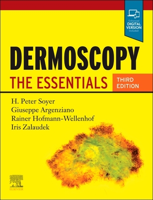 Dermoscopy: The Essentials - Soyer, H. Peter, and Argenziano, Giuseppe, and Hofmann-Wellenhof, Rainer