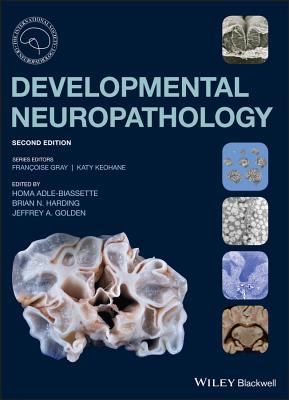 Developmental Neuropathology - Adle-Biassette, Homa (Editor), and Harding, Brian N. (Editor), and Golden, Jeffrey A. (Editor)