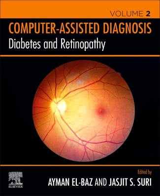 Diabetes and Retinopathy - S. El-Baz, Ayman (Editor), and Suri, Jasjit (Editor)