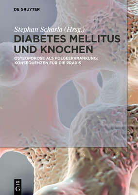 Diabetes Mellitus Und Knochen: Osteoporose ALS Folgeerkrankung: Konsequenzen F?r Die PRAXIS - Scharla, Stephan (Editor)