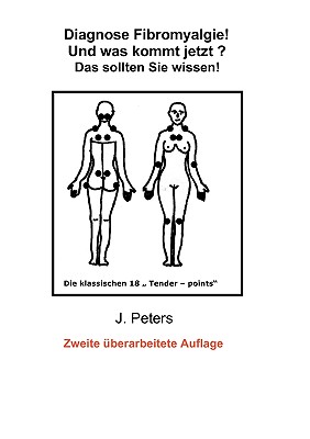 Diagnose Fibromyalgie! Und was kommt jetzt?: Das sollten sie Wissen! - Peters, Joachim, Dr.