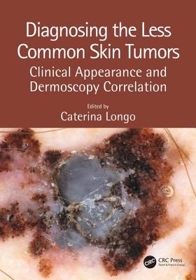 Diagnosing the Less Common Skin Tumors: Clinical Appearance and Dermoscopy Correlation - Longo, Caterina (Editor)