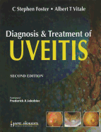 Diagnosis & Treatment of Uveitis