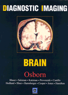 Diagnostic Imaging Brain - Osborn, Anne G, MD, and Blaser, Susan I, MD, and Salzman, Karen L, MD
