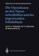 Die Operationen an Den Nasennebenhohlen Und Der Angrenzenden Schadelbasis