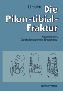 Die Pilon-Tibial-Fraktur: Klassifikation, Operationstechnik, Ergebnisse