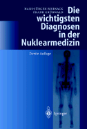 Die Wichtigsten Diagnosen in Der Nuklearmedizin