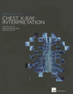 Discover Radiology: Chest X-Ray Interpretation