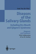 Diseases of the Salivary Glands Including Dry Mouth and Sjogren S Syndrome: Diagnosis and Treatment