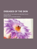 Diseases of the Skin: An Outline of the Principles and Practice of Dermatology