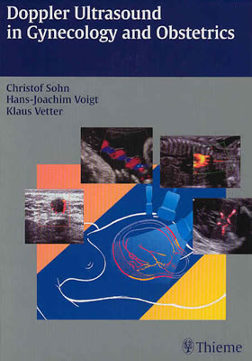 Doppler Ultrasound in Gynecology and Obstetrics - Sohn, Christof (Editor), and Voigt, Hans-Joachim (Editor), and Vetter, Klaus, M.D (Editor)