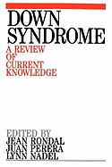 Down Syndrome: A Review of Current Knowledge