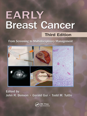 Early Breast Cancer: From Screening to Multidisciplinary Management, Third Edition - Benson, John R (Editor), and Gui, Gerald P.H. (Editor), and Tuttle, Todd (Editor)