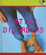 Eating Disorders