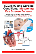 ECG/EKG and Cardiac Conditions: Interpreting Key Disease Patterns: Noting Key ECG/EKG Signs of Heart Conditions for Easy Interpretation for All