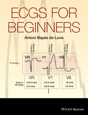 ECGs for Beginners - Bays de Luna, Antoni