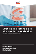 Effet de la posture de la t?te sur la malocclusion