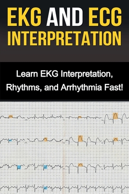 EKG and ECG Interpretation: Learn EKG Interpretation, Rhythms, and Arrhythmia Fast! - Stone, Alyssa