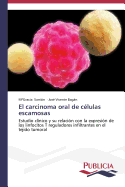 El Carcinoma Oral de Celulas Escamosas
