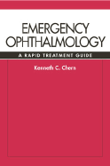 Emergency Ophthalmology: A Rapid Treatment Guide