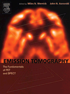 Emission Tomography: The Fundamentals of Pet and Spect
