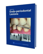 Endo-periodontal Lesion
