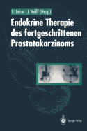 Endokrine Therapie Des Fortgeschrittenen Prostatakarzinoms