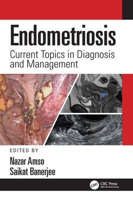 Endometriosis: Current Topics in Diagnosis and Management - Amso, Nazar (Editor), and Banerjee, Saikat (Editor)