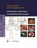 Endoscopic Endonasal Transsphenoidal Surgery - Divitiis, Enrico de (Editor), and Cappabianca, Paolo (Editor)