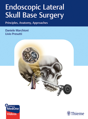 Endoscopic Lateral Skull Base Surgery: Principles, Anatomy, Approaches - Marchioni, Daniele (Editor), and Presutti, Livio (Editor)