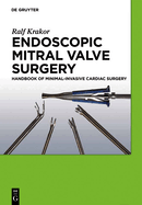 Endoscopic Mitral Valve Surgery: Handbook of Minimal-Invasive Cardiac Surgery